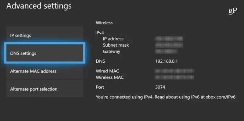حل ارور diver وارزون xbox با تغییر dns