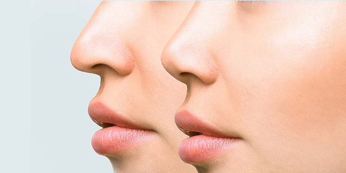 آموزش تصویری جراحی ، تغییر فرم و کوچک کردن بینی در فتوشاپ
