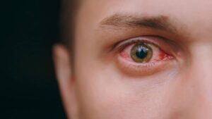 درمان انواع آسیب‌های چشمی با سلول‌های بنیادی ممکن شد