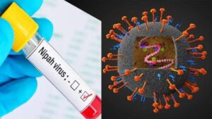 وحشت یک همه‌گیری ترسناک و جدید: ویروس نیپا چیست و چه علائمی دارد؟