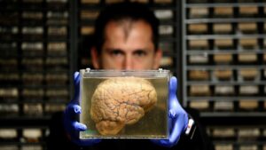 آیا واقعاً مغز افراد پولدار دیرتر پیر می‌شود؟